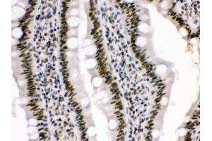 Anti- HMG4 Picoband antibody, IHC(P) IHC(P): Rat Intestine Tissue (HMGB3 抗体  (N-Term))
