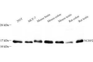 Western blot analysis of NCBP2 (ABIN7074870) at dilution of 1: 300 (NCBP2 抗体)