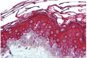 Human Skin (formalin-fixed, paraffin-embedded) stained with ALAS1 antibody ABIN290712 at 5 ug/ml followed by biotinylated goat anti-rabbit IgG secondary antibody ABIN481713, alkaline phosphatase-streptavidin and chromogen. (ALAS1 抗体  (AA 480-530))