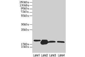 Western blot All lanes: DHRS3 antibody at 0. (DHRS3 抗体  (AA 30-169))