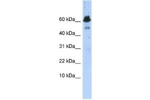 WB Suggested Anti-ABAT Antibody Titration: 0. (ABAT 抗体  (Middle Region))