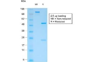 SDS-PAGE Analysis Purified CD44v4 Mouse Recombinant Monoclonal Antibody (rCD44v4/1219). (Recombinant CD44 抗体)