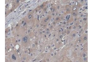 Immunohistochemistry (IHC) image for anti-N-Acetylglucosaminidase, alpha (NAGLU) (AA 485-743) antibody (ABIN7435373)