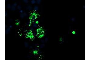 Anti-CAMLG mouse monoclonal antibody (ABIN2455753) immunofluorescent staining of COS7 cells transiently transfected by pCMV6-ENTRY CAMLG (RC218292). (CAMLG 抗体)