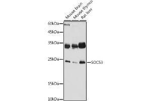 Western blot analysis of extracts of various cell lines, using SOCS3 antibody (ABIN3015316, ABIN3015317, ABIN5663764 and ABIN6213984) at 1:1000 dilution. (SOCS3 抗体  (C-Term))