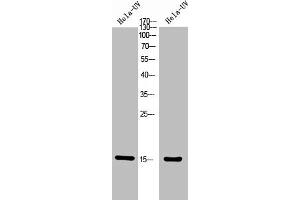 Western Blot analysis of Hela+UV 5' cells using Phospho-Histone H2A (T121) Polyclonal Antibody. (HIST1H2AG/HIST1H2AB/HIST1H2AD/HIST1H2AH/HIST2H2AA3/HIST3H2A (pThr121) 抗体)