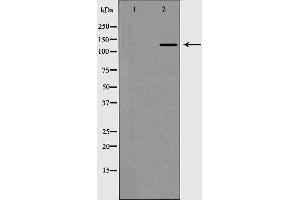 Western blot analysis of Collagen III expression in HT1080 Whole cell lysate. (COL3A1 抗体  (N-Term))