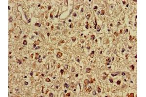Immunohistochemistry of paraffin-embedded human glioma using ABIN7159696 at dilution of 1:100 (IMMT 抗体  (AA 76-215))
