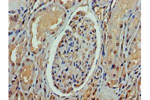 Immunohistochemistry (IHC) image for anti-Set1/Ash2 Histone Methyltransferase Complex Subunit ASH2 (ASH2L) (AA 1-534) antibody (ABIN7169424)