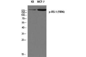 Western Blot (WB) analysis of KB MCF-7 using p-IRS-1 (Y896) antibody. (IRS1 抗体  (pTyr896))