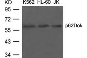 Image no. 3 for anti-Docking Protein 1, 62kDa (Downstream of tyrosine Kinase 1) (DOK1) (Tyr398) antibody (ABIN197538) (DOK1 抗体  (Tyr398))