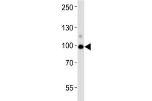 Western Blotting (WB) image for anti-Angiotensin I Converting Enzyme 2 (ACE2) (AA 140-172) antibody (ABIN3029963)