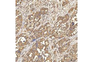 IHC analysis of Citrin/SLC25A13 using anti-Citrin/SLC25A13 antibody (ABIN7599512). (slc25a13 抗体  (AA 1-643))