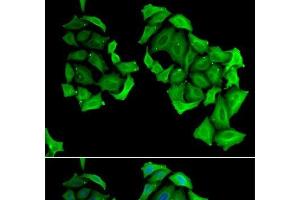 Immunofluorescence analysis of HeLa cells using C4BPB Polyclonal Antibody (C4BPB 抗体)
