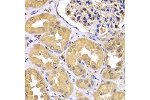Immunohistochemistry of paraffin-embedded human kidney using LZTR1 antibody (ABIN5975506) at dilution of 1/100 (40x lens). (LZTR1 抗体)