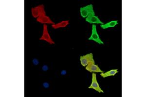 ABIN7095945 and ABIN7100007 staining Hela cells by IF/ICC. (RASGRP4 抗体)