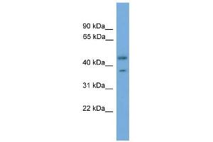 WB Suggested Anti-PRPSAP2 Antibody Titration: 0. (PRPSAP2 抗体  (Middle Region))