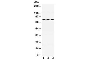 Western blot testing of 1) rat liver, 2) mouse HEPA and 3) A549 lysate with ACSL1 antibody at 0. (ACSL1 抗体)