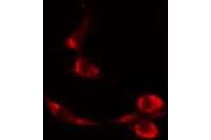 ABIN6277088 staining  Hela cells by IF/ICC. (Progesterone Receptor 抗体  (Internal Region))
