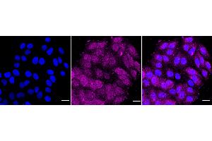Immunocytochemical staining of HepG2 cells with caspase 8 antibody (ABIN7797907), 1:1,000). (Recombinant Caspase 8 抗体)