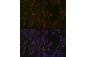 Immunofluorescence (IF) image for anti-ClpP Caseinolytic Peptidase, ATP-Dependent, Proteolytic Subunit Homolog (E. Coli) (CLPP) antibody (ABIN1682296)