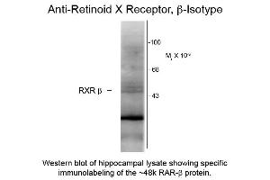 Western blot of Anti-Retinoid X Receptor beta (Mouse) Antibody - 200-301-E27 Western Blot of Mouse anti-Retinoid X Receptor beta antibody. (Retinoid X Receptor beta 抗体)