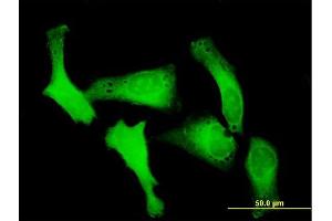Immunofluorescence of purified MaxPab antibody to RANBP5 on HeLa cell. (Importin 5 抗体  (AA 1-1115))