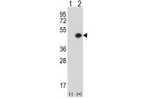 Western blot analysis of BMP7 antibody and 293 cell lysate either nontransfected (Lane 1) or transiently transfected (2) with the BMP7 gene. (BMP7 抗体  (AA 280-309))