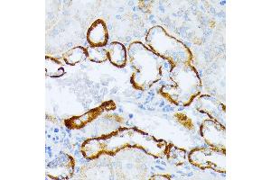 Immunohistochemistry of paraffin-embedded mouse kidney using IL3RA antibody (ABIN1680453, ABIN3018298, ABIN3018299, ABIN5664529 and ABIN6220429) at dilution of 1:100 (40x lens). (IL3RA 抗体  (AA 1-100))