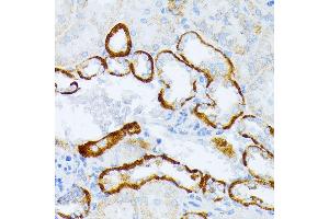 Immunohistochemistry of paraffin-embedded mouse kidney using IL3RA antibody (ABIN1680453, ABIN3018298, ABIN3018299, ABIN5664529 and ABIN6220429) at dilution of 1:100 (40x lens). (IL3RA 抗体  (AA 1-100))