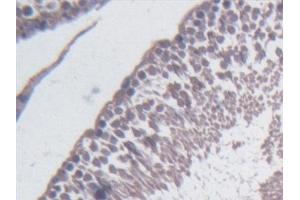 Immunohistochemistry (IHC) image for anti-Branched Chain Amino-Acid Transaminase 1, Cytosolic (BCAT1) (AA 179-411) antibody (ABIN7445063)