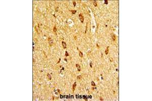 Formalin-fixed and paraffin-embedded human brain tissue with H Cadherin (CDH13) Antibody (N-term), which was peroxidase-conjugated to the secondary antibody, followed by DAB staining. (Cadherin 13 抗体  (N-Term))