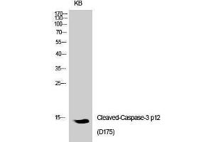 Western Blotting (WB) image for anti-Caspase 3 p12 (Asp175), (cleaved) antibody (ABIN3181760) (Caspase 3 p12 (Asp175), (cleaved) 抗体)