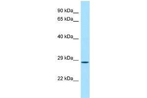WB Suggested Anti-Cfdp1 Antibody Titration: 1. (CFDP1 抗体  (C-Term))