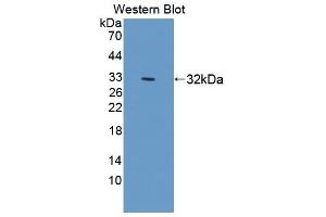 Detection of Recombinant SIRPa, Mouse using Polyclonal Antibody to Signal Regulatory Protein Alpha (SIRPa) (SIRPA 抗体  (AA 56-296))