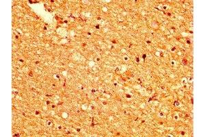 IHC image of ABIN7164465 diluted at 1:500 and staining in paraffin-embedded human brain tissue performed on a Leica BondTM system. (GPR158 抗体  (AA 882-1003))