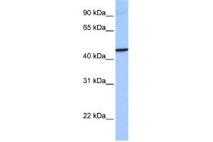 WB Suggested Anti-GBP4 Antibody Titration: 0. (GBP4 抗体  (Middle Region))