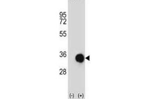 Western blot analysis of Caspase-6 antibody and 293 cell lysate (2 ug/lane) either nontransfected (Lane 1) or transiently transfected (2) with the CASP6 gene. (Caspase 6 抗体  (AA 17-45))