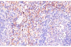 Immunohistochemistry of paraffin-embedded Mouse spleen using RAP1A Polyclonal Antibody at dilution of 1:100 (40x lens). (RAP1A 抗体)