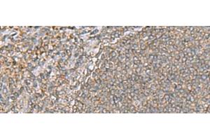 Immunohistochemistry of paraffin-embedded Human tonsil tissue using ARF5 Polyclonal Antibody at dilution of 1:55(x200) (ARF5 抗体)