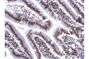Immunohistochemistry (IHC) image for anti-Cofactor of BRCA1 (COBRA1) (Center) antibody (ABIN2855267)