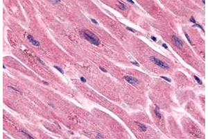 Immunohistochemistry (Formalin/PFA-fixed paraffin-embedded sections) of human heart tissue with FZD7 polyclonal antibody . (FZD7 抗体  (N-Term))