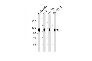 All lanes : Anti-LP2 Antibody at 1:2000 dilution Lane 1: H. (LAMP2 抗体)