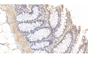 Immunohistochemistry (IHC) image for anti-Interleukin 10 (IL10) (AA 19-175) antibody (ABIN7427054)