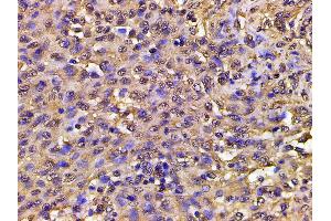 Immunohistochemistry (IHC) image for anti-Phosphoinositide 3 Kinase, p85 alpha (PI3K p85a) (pTyr607) antibody (ABIN6256775)