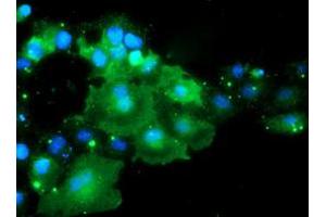 Anti-DOK7 mouse monoclonal antibody (ABIN2455821) immunofluorescent staining of COS7 cells transiently transfected by pCMV6-ENTRY DOK7 (RC219267). (DOK7 抗体)