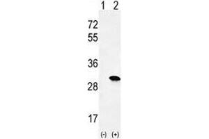 Western blot analysis of H-RAS antibody and 293 cell lysate either nontransfected (Lane 1) or transiently transfected (2) with the HRAS gene. (HRAS 抗体  (AA 146-176))