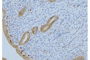 ABIN6275548 at 1/100 staining Human uterus tissue by IHC-P. (PPP2R1B 抗体  (C-Term))