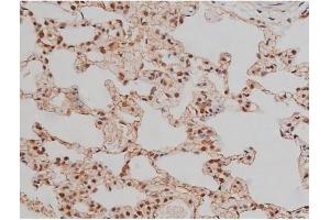 Immunohistochemistry (IHC) image for anti-Sp1 Transcription Factor (SP1) (pThr453) antibody (ABIN6256566)