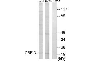 Immunohistochemistry analysis of paraffin-embedded human heart tissue using CBF β antibody. (CBFB 抗体)